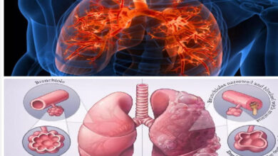 मुख्यमंत्री और स्वास्थ्य मंत्री के नेतृत्व में छत्तीसगढ़ में (सीओपीडी) जागरूकता की क्रांतिकारी पहल-महेन्द्र सिंह मरपच्ची