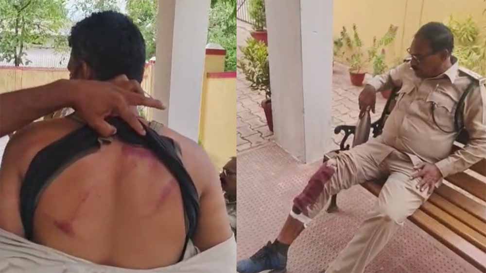 बालोद में पर्रकुलेशन टेंक का निरीक्षण करने पहुंची वन विभाग की टीम पर लाठी-डंडे से हमला, डिप्टी रेंजर समेत 4 घायल