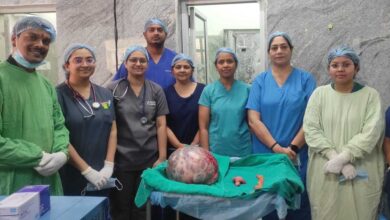 रायपुर : सिम्स में जटिल सर्जरी, 65 वर्षीय महिला के पेट से निकाला गया 10 किलो से अधिक वजन का ट्यूमर
