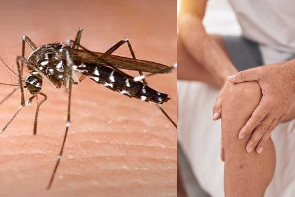 स्वास्थ्य विभाग की रिपोर्ट में खुलासा, इस साल अब तक चिकनगुनिया के मामले डेंगू से ज्यादा स्वास्थ्य विभाग की रिपोर्ट में खुलासा, इस साल अब तक चिकनगुनिया के मामले डेंगू से ज्यादा