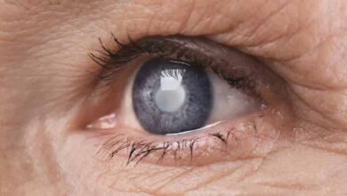 मुश्किल नहीं है मोतियाबिंद का इलाज