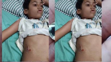 पेबल बे फेस 1, बागमुगलिया कटारा हिल्स में आवारा कुत्ते ने बच्चे को काटा