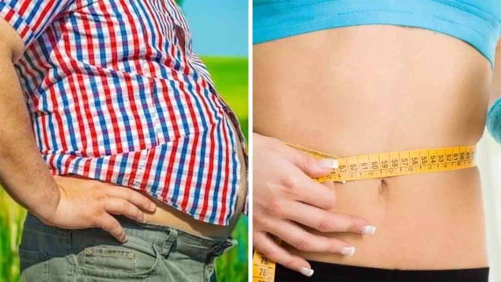 MP को मिलेगा पहला सरकारी ओबेसिटी क्लीनिक, जांच से सर्जरी तक सब फ्री