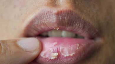 रूखे होंठों की समस्या? किचन की ये चीजें वापस लाएंगी निखार