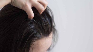 ड्राय स्कैल्प के लिए अपनाएं ये 3 घरेलू उपाय
