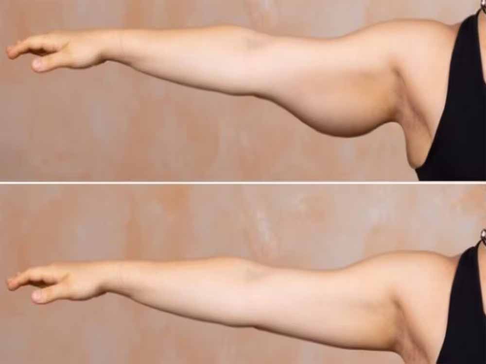 बाजू की ढीली मांसपेशियों को टोन्ड बनाने के लिए रोज करें ये 5 एक्सरसाइज, बढ़ जाएगी हाथों की ताकत