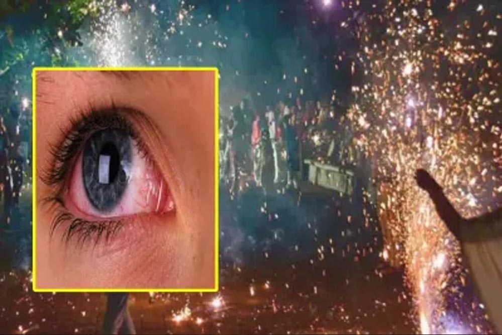 भोपाल में पटाखा गन चेक के दौरान फायरिंग, बच्चे की आंख को गंभीर नुकसान; एम्स ने जारी की एडवाइजरी भोपाल में पटाखा गन चेक के दौरान फायरिंग, बच्चे की आंख को गंभीर नुकसान; एम्स ने जारी की एडवाइजरी