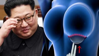 किम जोंग उन का फरमान: उत्तर कोरिया में ब्रेस्ट इम्प्लांट और प्लास्टिक सर्जरी पर सख्त प्रतिबंध