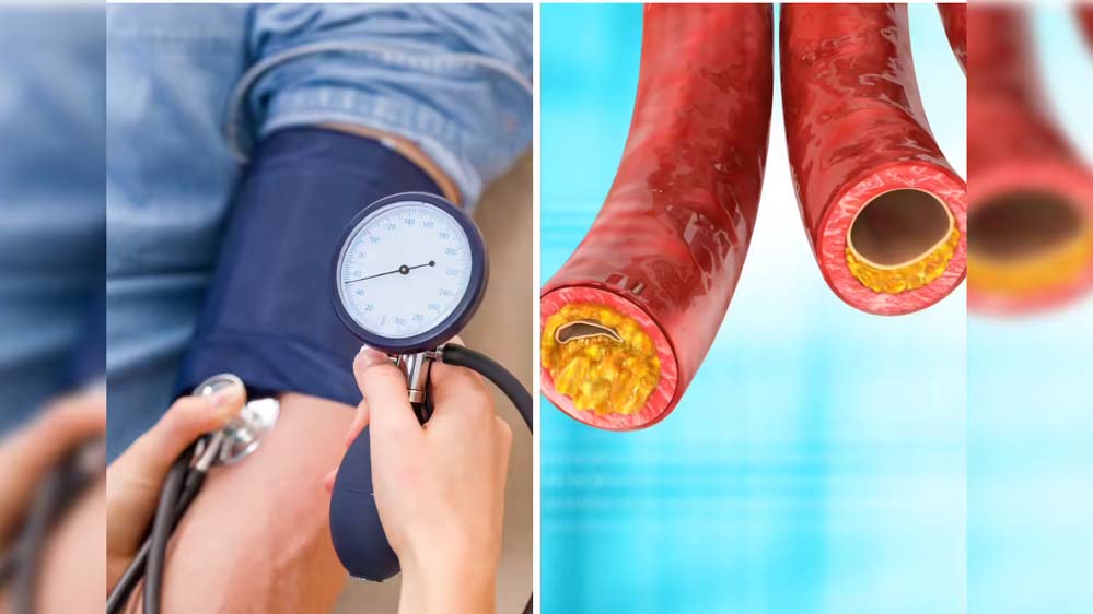 इंदौर में 30% लोगों को हाई बीपी-शुगर, 40% में कोलेस्ट्रॉल की समस्या; 4 लाख की स्क्रीनिंग में हुआ खुलासा