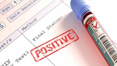 HIV रिपोर्ट गोपनीयता पर नई गाइडलाइन: अब सिर्फ डॉक्टर ही देख सकेंगे मरीज की जानकारी