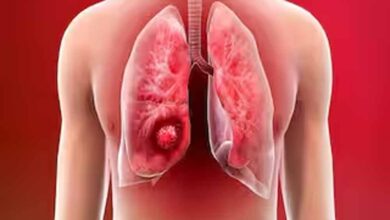 फेफड़ों के कैंसर पर वैज्ञानिकों की बड़ी जीत! नया शोध ट्यूमर को 80% तक सिकोड़ने में सफल