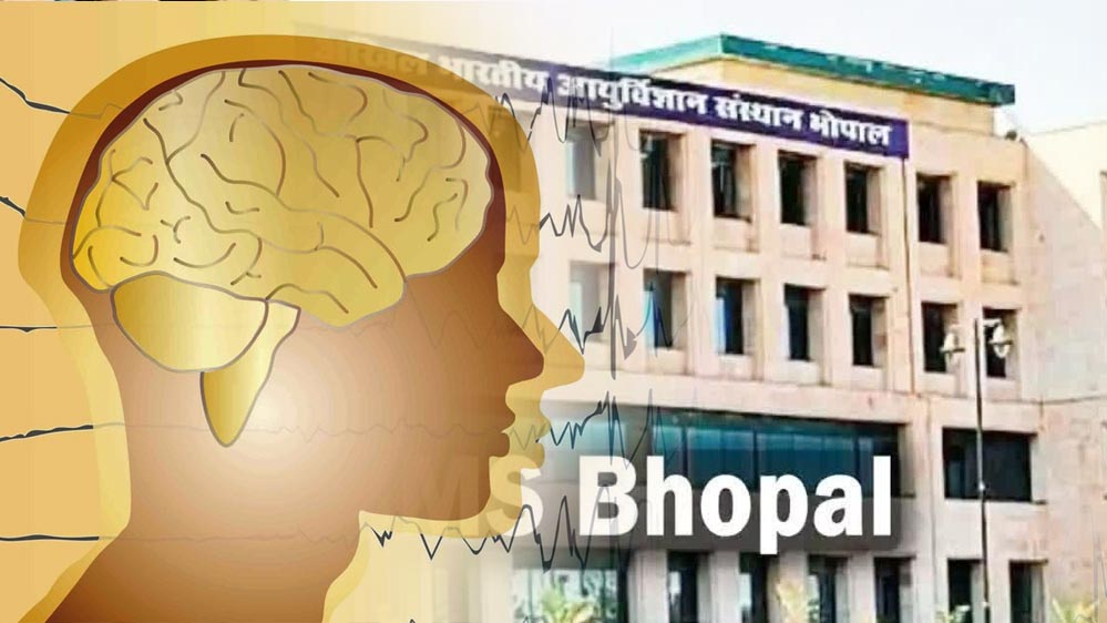 AIIMS भोपाल की बड़ी उपलब्धि: 24 घंटे में होगा स्ट्रोक का एडवांस्ड इलाज, ब्रेन का थक्का होगा दूर