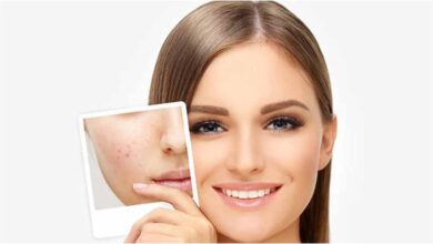 हरे के दाग-धब्बों और पिगमेंटेशन को करे मात, चावल का यह घरेलू नुस्खा आजमाएं!