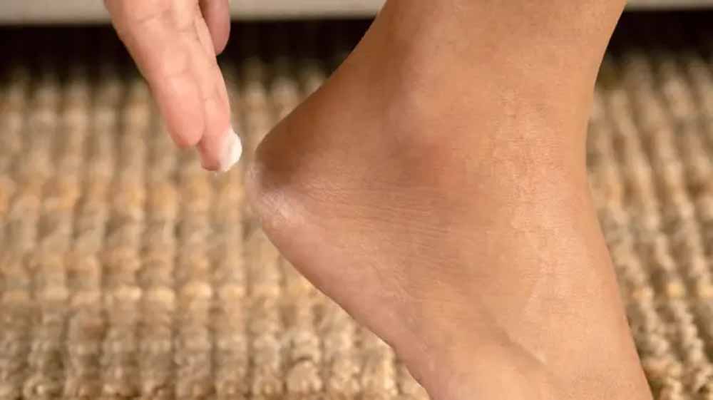 सर्द के मौसम में एड़ियों की करें सही देखभाल! सर्द के मौसम में एड़ियों की करें सही देखभाल!