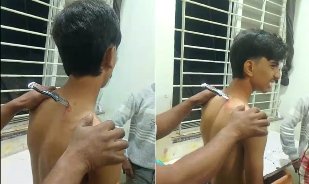 महिदपुर में मामूली विवाद के दौरान नाबालिग पर हमला, घायल 46 किमी दूर अस्पताल पहुंचा