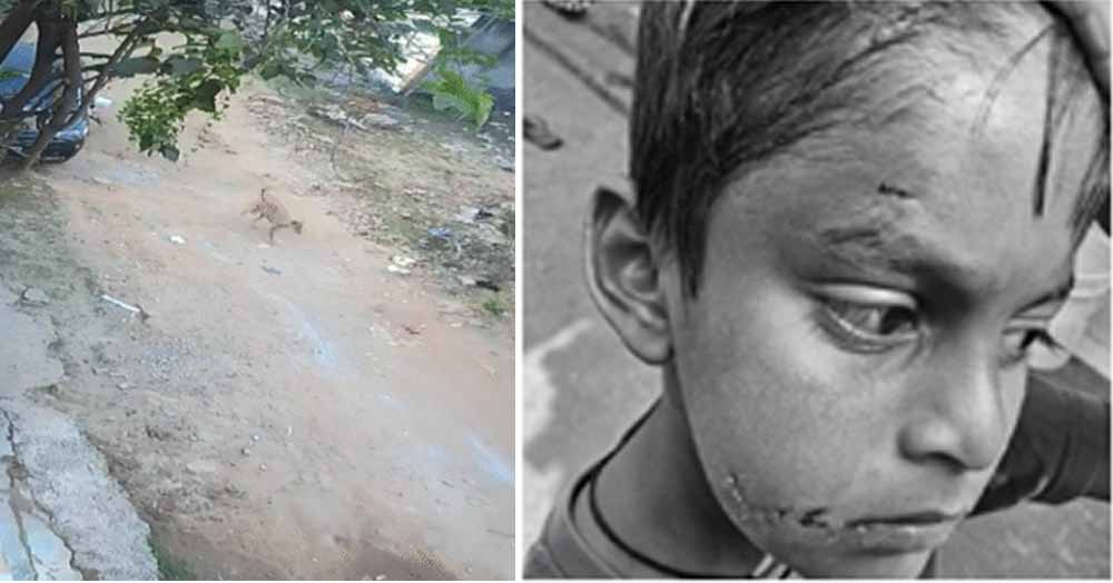 बिलासपुर में PM श्री स्कूल के अंदर कुत्ते ने पहली कक्षा के बच्चे को नोचा, बचाने दौड़ी टीचर पर भी किया हमला