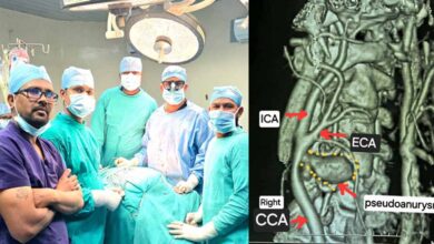 छत्तीसगढ़ के मेकाहारा हॉस्पिटल के डॉक्टरों ने दी नई जिंदगी, ब्रश करते समय फटी गर्दन की नस की दुर्लभ सर्जरी की