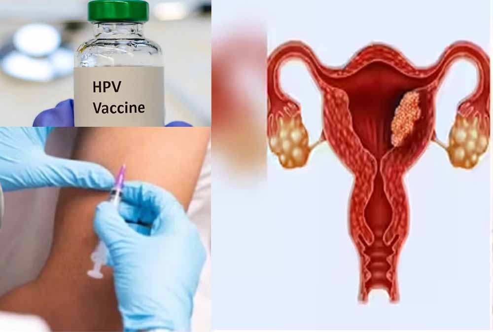 भारत में फेमस हैं HPV वैक्सीन से जुड़े 3 मिथक, डॉक्टर से जानें सही उम्र और सच्चाई