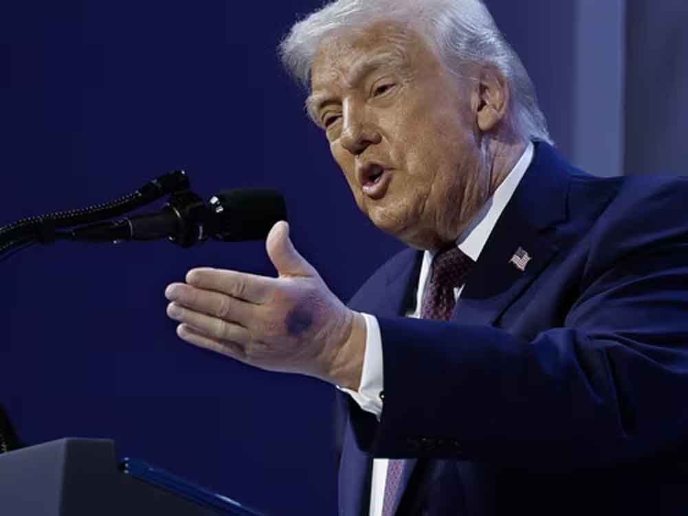 ट्रंप के हाथ पर नीले निशान क्यों? ‘बीमारी’ की अटकलों पर राष्ट्रपति ने खुद तोड़ी चुप्पी ट्रंप के हाथ पर नीले निशान क्यों? ‘बीमारी’ की अटकलों पर राष्ट्रपति ने खुद तोड़ी चुप्पी