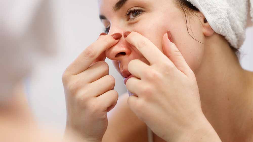 पिंपल्स फोड़ना पड़ सकता है भारी, चेहरा खराब होने और इन्फेक्शन का बढ़ता है खतरा