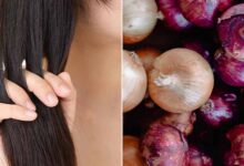प्याज का तेल: हेयर फॉल रोकने का घरेलू नुस्खा