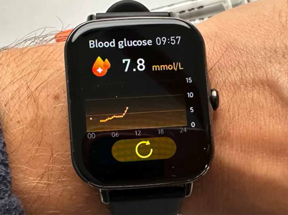 क्या स्मार्टवॉच से पता चलेगा डायबिटीज का खतरा? दुबई में शुरू हुआ खास टेक ट्रायल