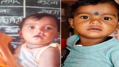 शासन की योजना से दूर हुई बेटी के भविष्य की चिंता, चिरायु दल ने लौटाई मासूम रंजना की मुस्कान