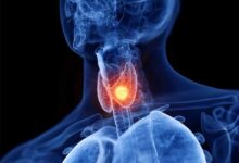 थाइरॉएड के मरीज क्यों न खाएं शुगर और सोया? जानें कारण