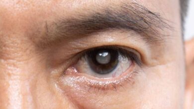 साइलेंट चोर ‘ग्लूकोमा’ से सावधान! आंखों में दिखें ये संकेत तो तुरंत कराएं जांच