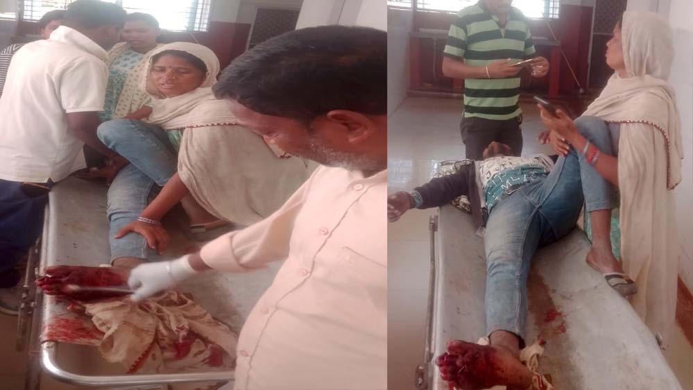 ऑटो और बाइक की भिंडत, बाइक चालक को आया गंभीर चोटें पैर की दो उंगली टूटने की आशंका