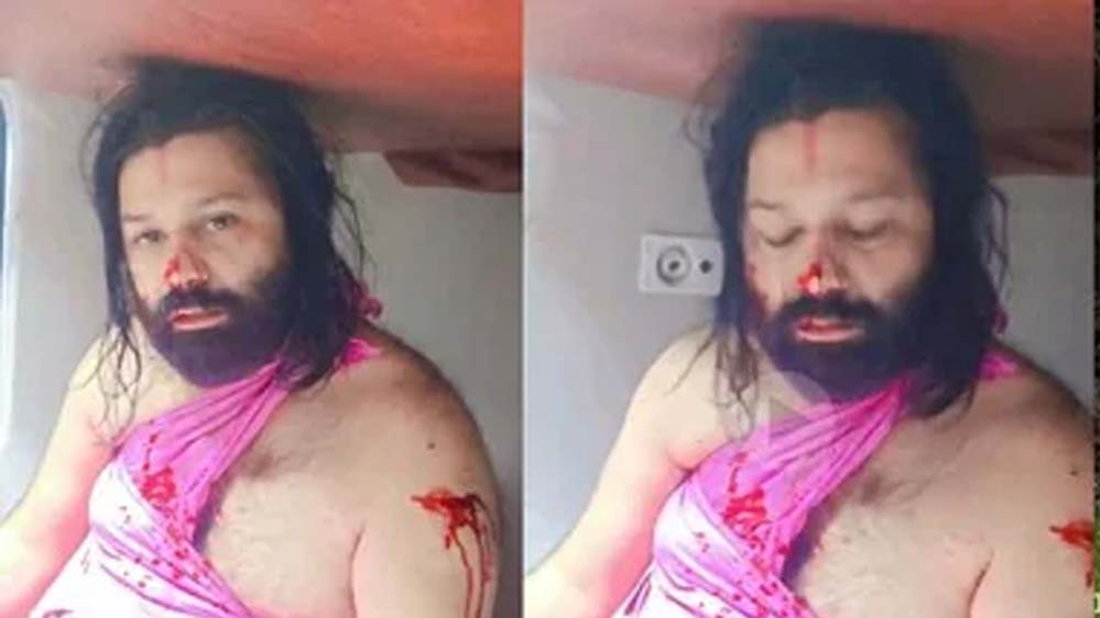 शंकराचार्य पर केस कराने वाले आशुतोष ब्रह्मचारी पर ट्रेन में जानलेवा हमला, नाक काटने की कोशिश शंकराचार्य पर केस कराने वाले आशुतोष ब्रह्मचारी पर ट्रेन में जानलेवा हमला, नाक काटने की कोशिश