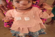 पिता के साये और आर्थिक तंगी के बीच चिरायु योजना बनी सहारा,अंजलि को मिला नया जीवन