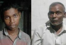 कुत्ते के काटने के बाद बच्चा करने लगा ‘भौंकने’ जैसी हरकत, जांच में निकली चौंकाने वाली बीमारी