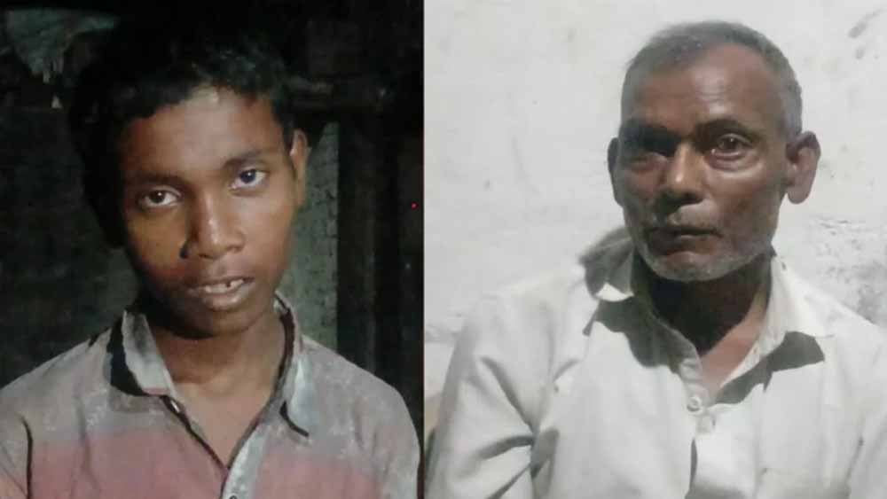 कुत्ते के काटने के बाद बच्चा करने लगा ‘भौंकने’ जैसी हरकत, जांच में निकली चौंकाने वाली बीमारी