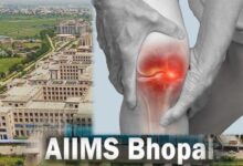 घुटनों के दर्द से मिलेगी परमानेंट मुक्ति, एम्स भोपाल और ग्वालियर आयुर्वेद संस्थान मिलकर खोजेंगे अचूक इलाज