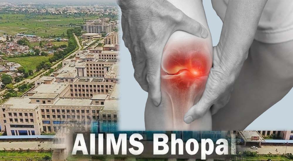 घुटनों के दर्द से मिलेगी परमानेंट मुक्ति, एम्स भोपाल और ग्वालियर आयुर्वेद संस्थान मिलकर खोजेंगे अचूक इलाज