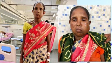 रायपुर: संजीवनी बना मेगा सुपर स्पेशलिटी हेल्थ कैंप, बुधरी मड़कम को मिला नया जीवन