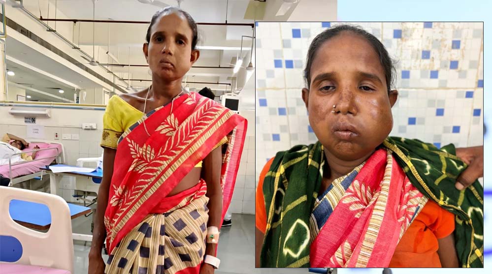 रायपुर: संजीवनी बना मेगा सुपर स्पेशलिटी हेल्थ कैंप, बुधरी मड़कम को मिला नया जीवन