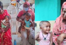 ‘प्रोजेक्ट धड़कन’ से 2 साल की पारूल को मिला नया जीवन