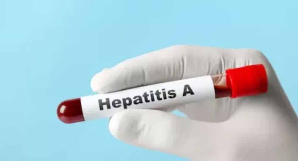 यूपी में हेपेटाइटिस ए का बड़ा खतरा, 97% सैंपल पॉजिटिव मिले