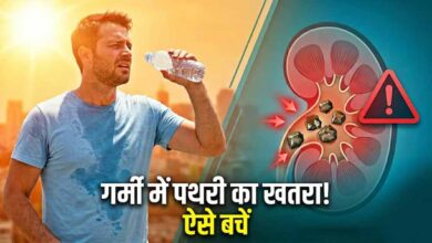 गर्मी में बढ़ा किडनी स्टोन का खतरा, डिहाइड्रेशन बन रहा बड़ा कारण