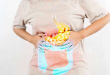 कब्ज से राहत के आयुर्वेदिक उपाय: घी, किशमिश और अंजीर से मिलेगा फायदा