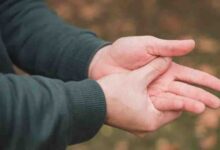 हाथों में बार-बार झुनझुनी और सुन्नपन को न करें नजरअंदाज, यह शरीर में छिपी इन बीमारियों का हो सकता है संकेत