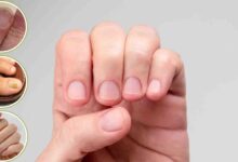 क्या आपके नाखून भी हो रहे हैं पीले या नीले? जानें शरीर में छिपी किन बीमारियों की ओर है यह इशारा