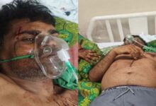 कुल्हाड़ी से हमला: गाली-गलौज का विरोध करने पर पूर्व जनपद सदस्य प्रतिनिधि पर जानलेवा वार