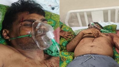 कुल्हाड़ी से हमला: गाली-गलौज का विरोध करने पर पूर्व जनपद सदस्य प्रतिनिधि पर जानलेवा वार