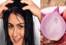 प्याज-अदरक शैंपू नहीं रोकते बाल झड़ना, जावेद हबीब ने बताई असली वजह