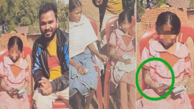 पत्थर शरीर वाली बच्ची के उपचार को लेकर बाल आयोग सक्रिय