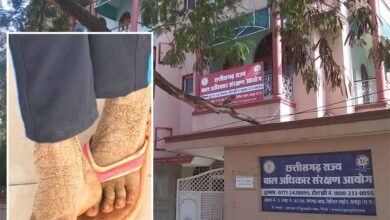बाल आयोग अध्यक्ष की पहल रंग लाई, गंभीर बीमार बालिका का इलाज शुरू