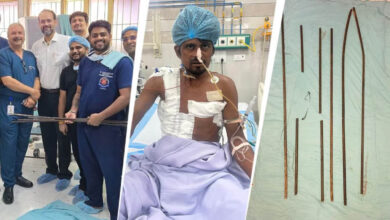 शरीर में आर-पार घुसे 4 लोहे के सरिये, KGMU के डॉक्टरों ने साढ़े आठ घंटे की सर्जरी से बचाई मजदूर की जान शरीर में आर-पार घुसे 4 लोहे के सरिये, KGMU के डॉक्टरों ने साढ़े आठ घंटे की सर्जरी से बचाई मजदूर की जान